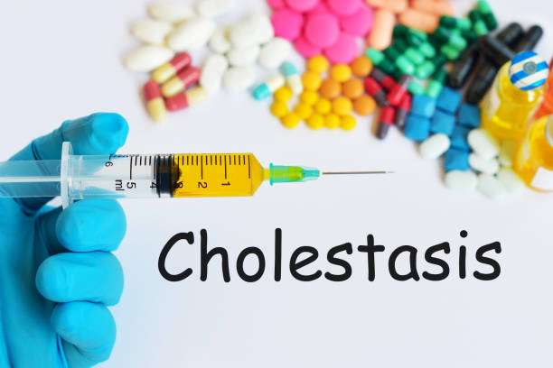  Cholestasis of pregnancy